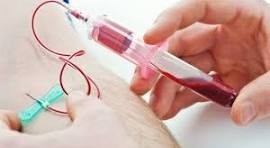 Is clinical effect of autologous conditioned serum in spontaneously occurring equine articular lameness related to ACS cytokine profile?